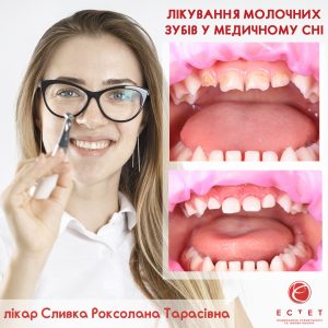 Лікування молочних зубів у медичному сні - Сливка Роксолана Тарасівна