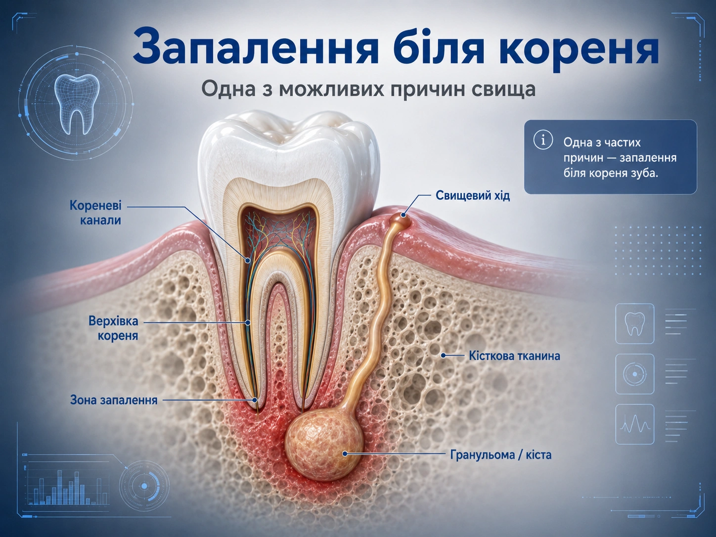діагностика свища на яснах у стоматолога