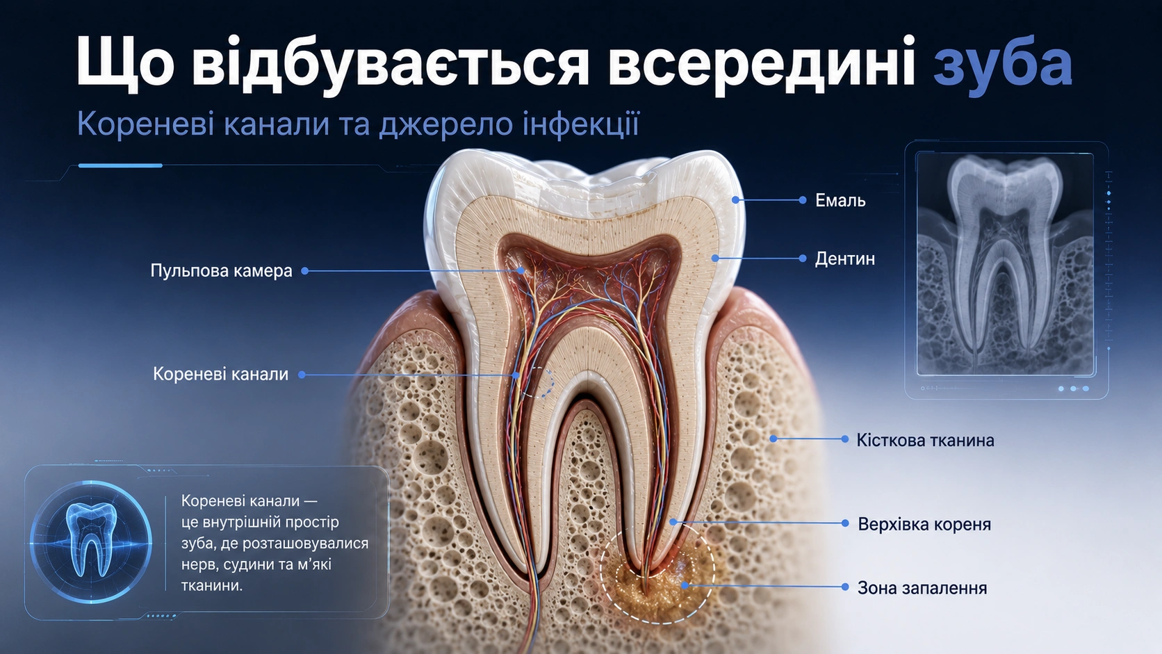 Схема анатомії кореневих каналів зуба перед повторним лікуванням